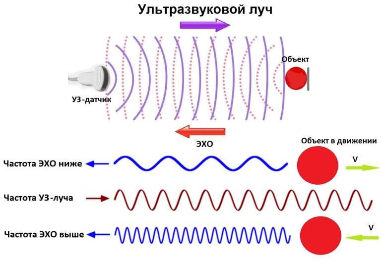 как работает узи