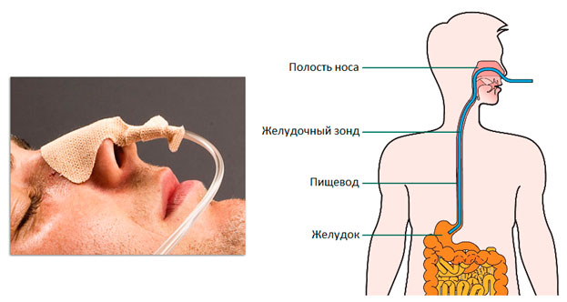 зонд