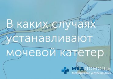 Когда установка мочевого катетера становится необходимостью: пошаговая инструкция по подготовке и восстановлению