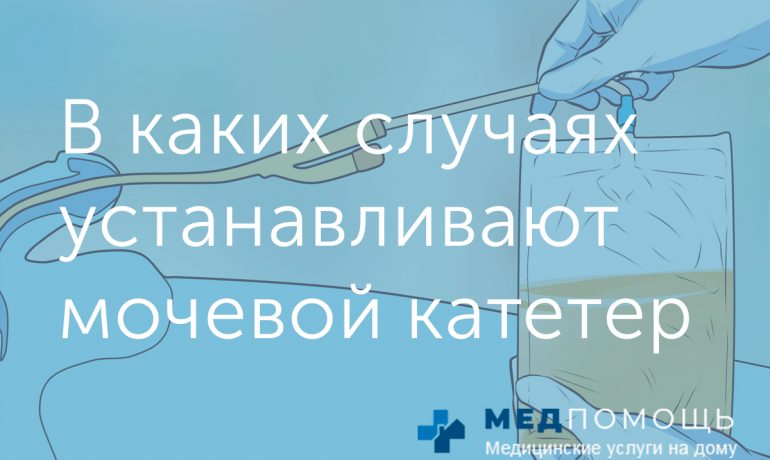 В каких случаях устанавливают мочевой катетер